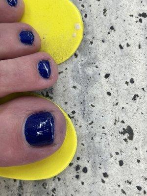 Horrible, crooked pedicure