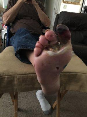 Jerald Kieffaber foot has been neglected by surgeon, now he needs more surgery. Suffering since August 2020.