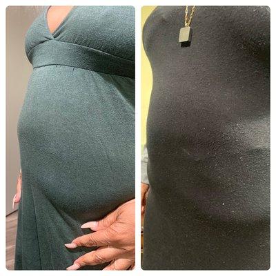 Before and after. Reduced bloating, client feeling lighter and is getting more restful sleep. The body responds to consistency!