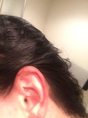 Yep, hair dye stained on my ear