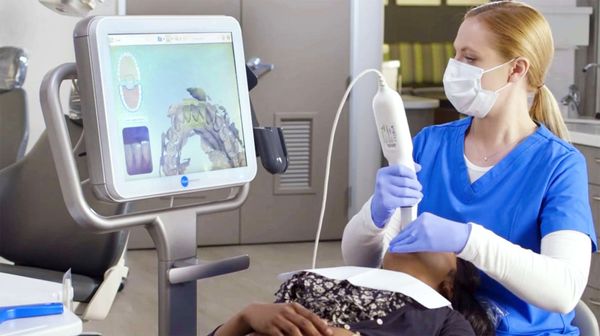 In office Intraoral scanner for digital impression of crowns, bridges and dental implants restoration