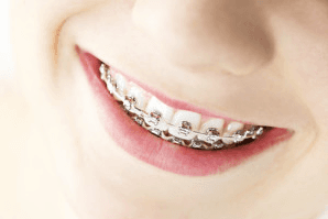 Orthodontics