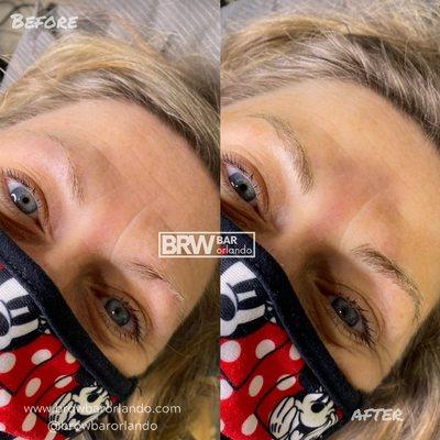 Microblading