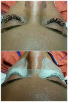 Before and after of a full set of eyelash extensions