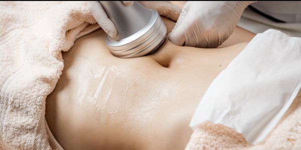 Ultrasound Cavitation-Most candidates for this treatment see their final result within 6 to 12 weeks.