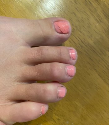 Toes look WORSE now than they did pre-pedi... how?!