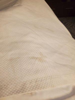 My bedding is disgusting. See the pictures they speak for themselves. I would leave but no hotels in the city.