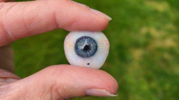 My prosthetic eye by Steve Young