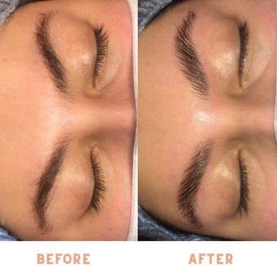 Before & After Brow Lamination