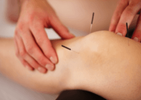 Joint pain? Let us help you. The best acupuncture clinic in Bakersfield.