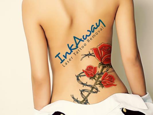 InkAway Laser Tattoo Removal -The Philadelphia Laser Tattoo Removal Experts