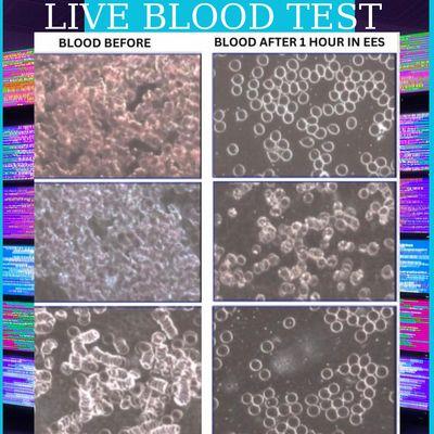 Experience visible results! Witness changes through live blood cell microscopy before and after your sessions in the EESystem.