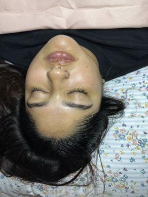 Dermaplaning Facial