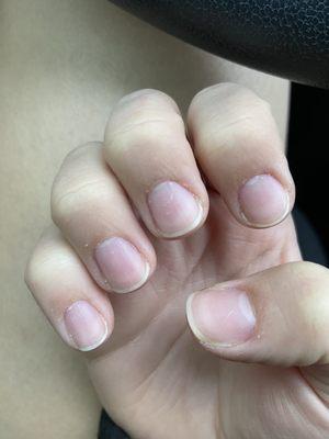 Cuticle care