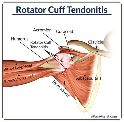 Receive Rotator cuff work like you have never experienced. Free up the movement in your shoulders and upper back.