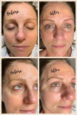 Microblading