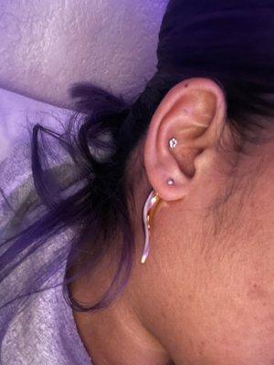 jewelry stuck in my earlobe