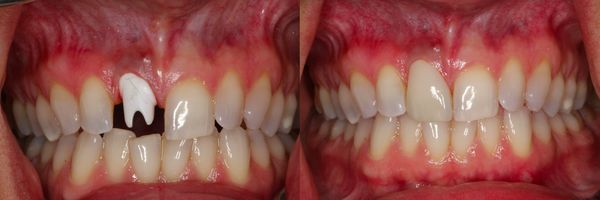 Cosmetic and Implant Dentistry of Connecticut | Branford, CT