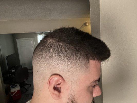 Skin fade