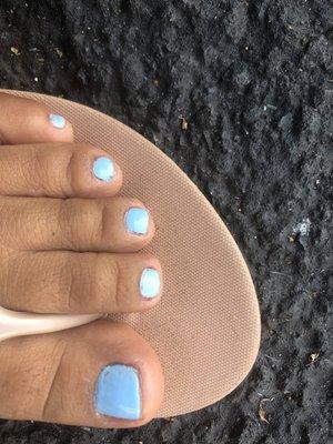 Pésimo pedicure