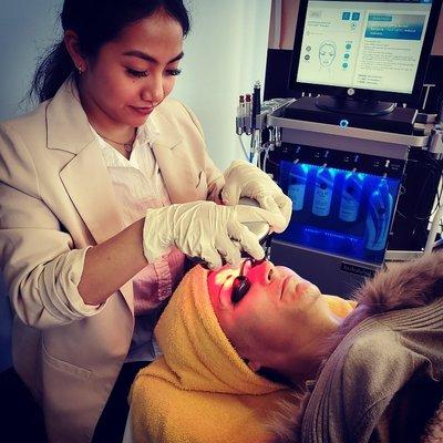 HydraFacial treatment at the DermaSmooth Clinic