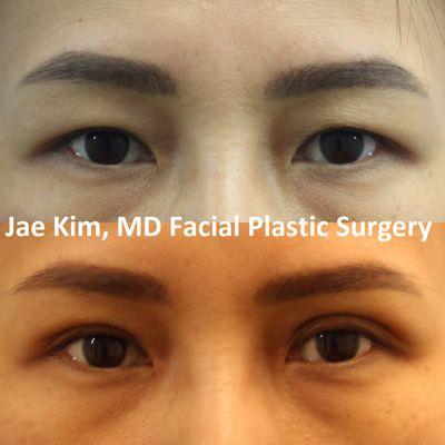 Jae Kim, MD Facial Plastic Surgery