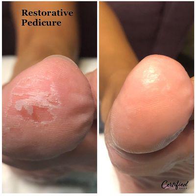 Restorative Pedicure