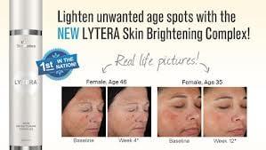 Award Winning Solution to unwanted age spots!