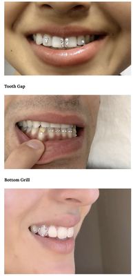 Tooth gap and grill styles