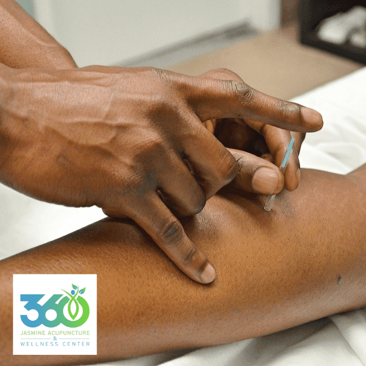 360 Jasmine Acupuncture & Wellness