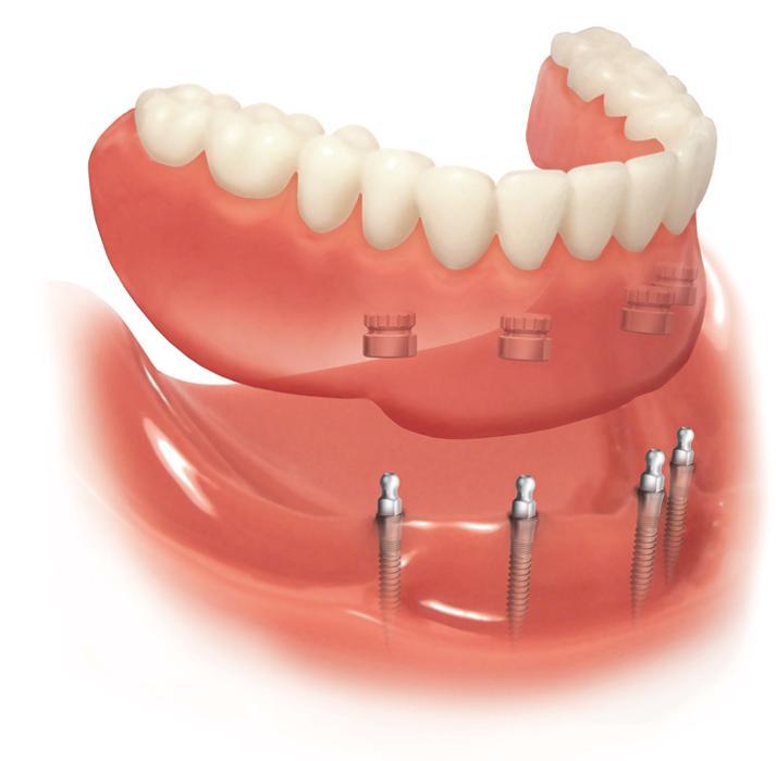 Dundas Denture Clinic